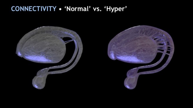 normal-vs-hyper